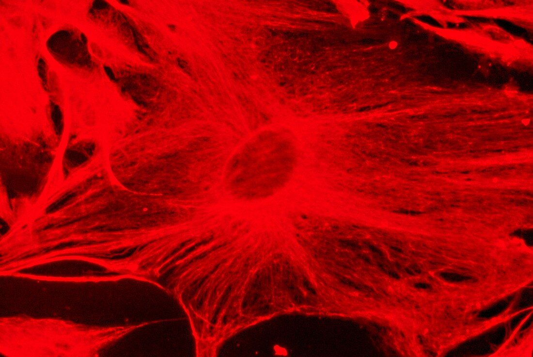 Neuroblastoma intermediate filament protein, LM Fluorescence