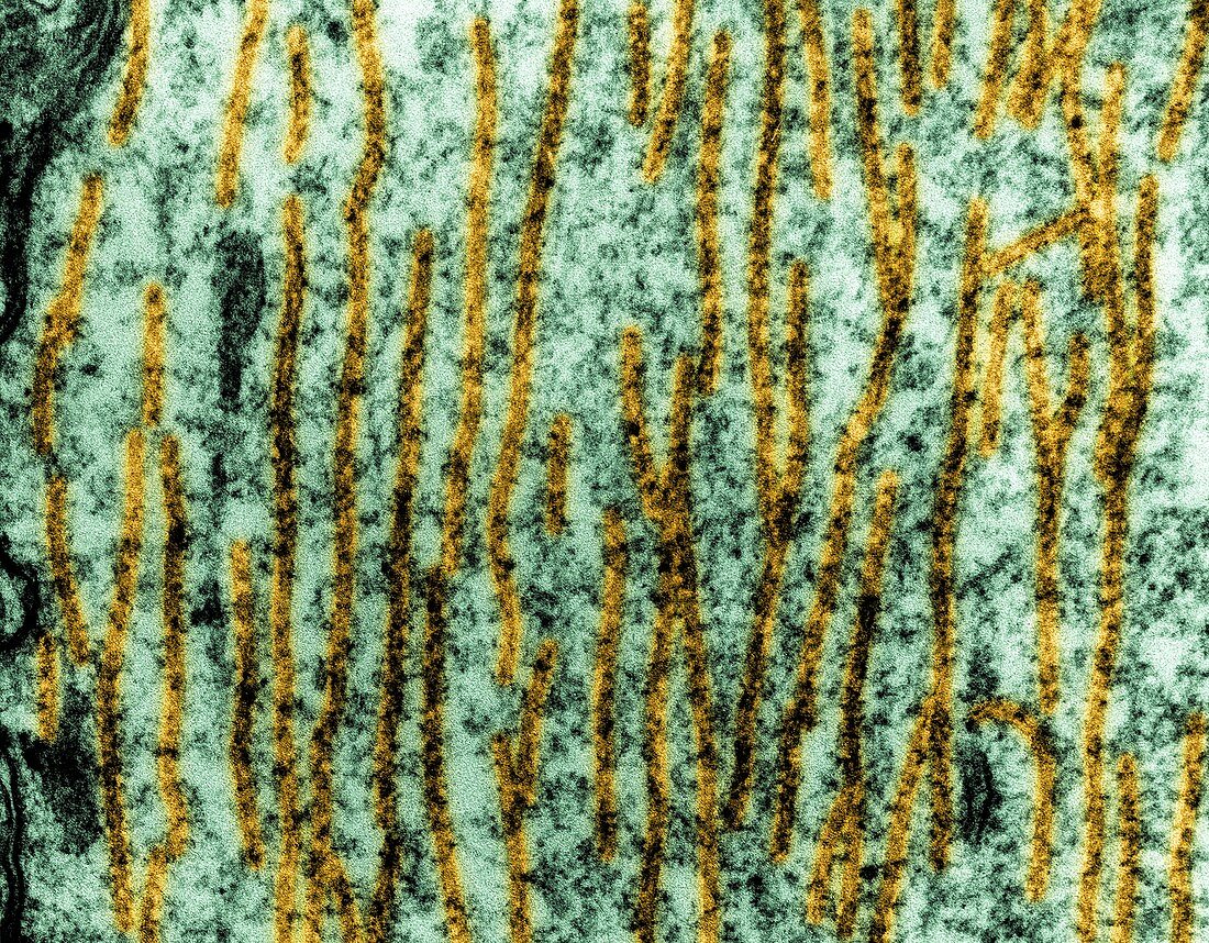 Microtubules in a neuron dendrite, TEM