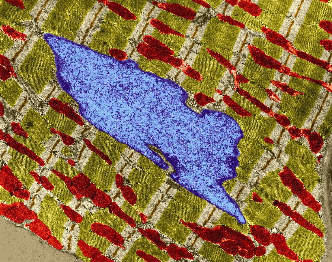 Heart muscle cell, TEM