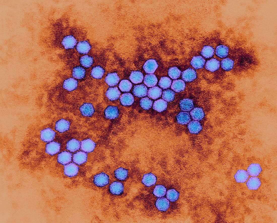 Polio virus, TEM