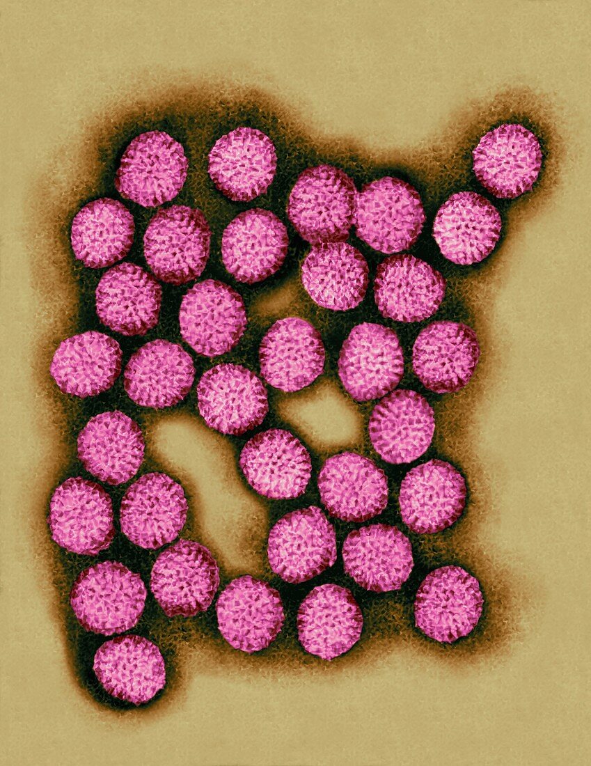 Rotavirus, TEM