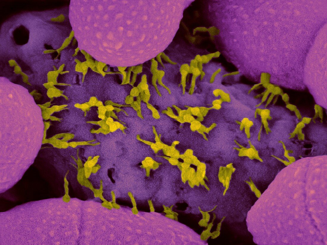 Bacteriophages escaping from dying bacterium, SEM