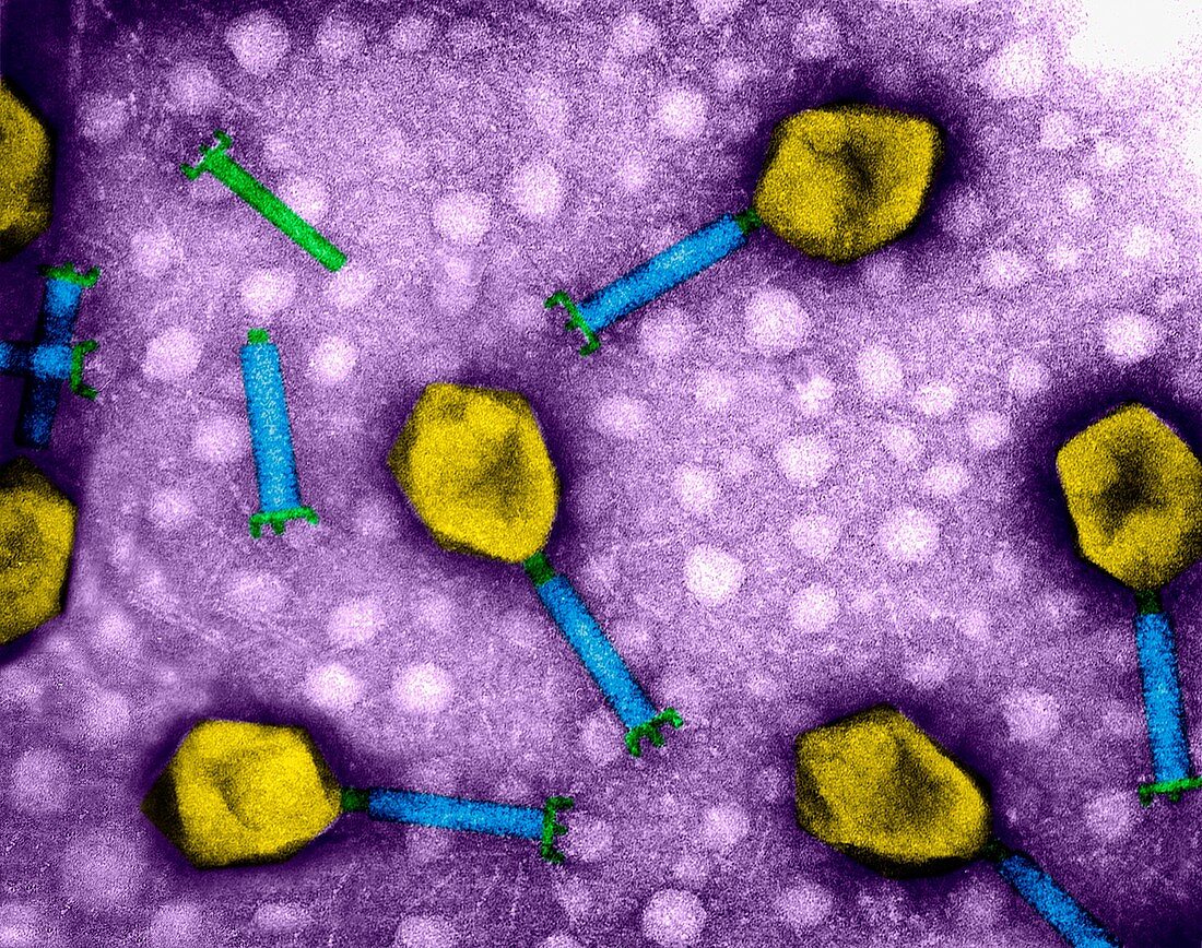 T4 bacteriophage, TEM