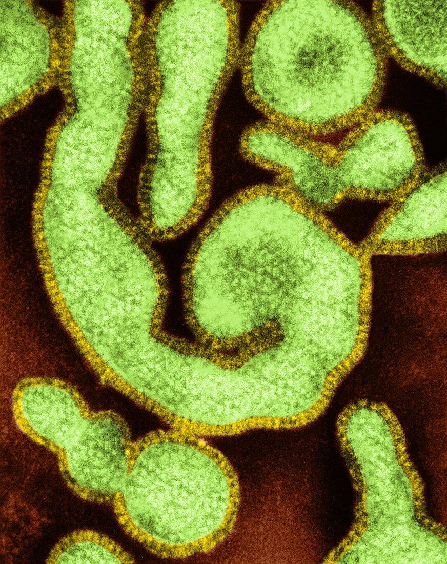 Influenza A virus, TEM