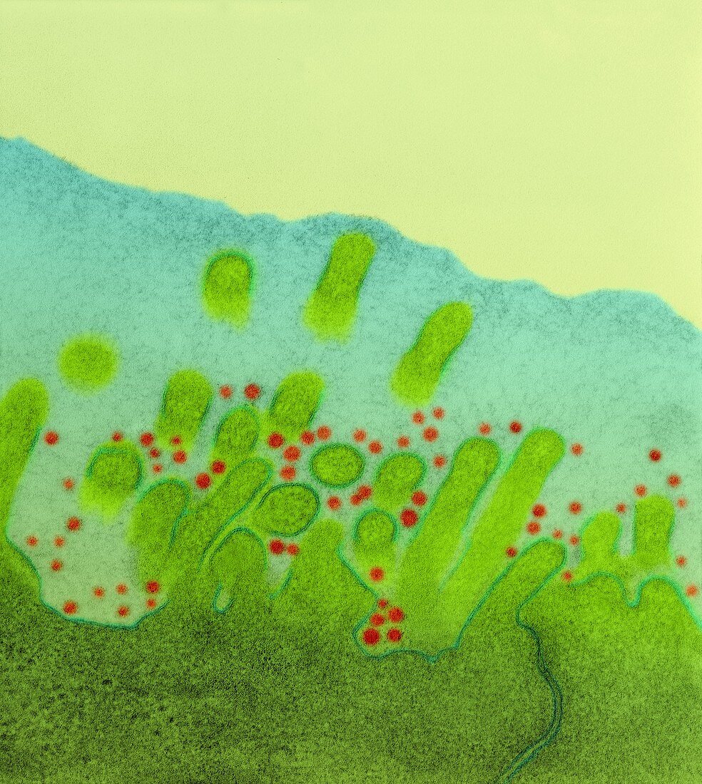 Rhinoviruses, cause of the common cold, TEM