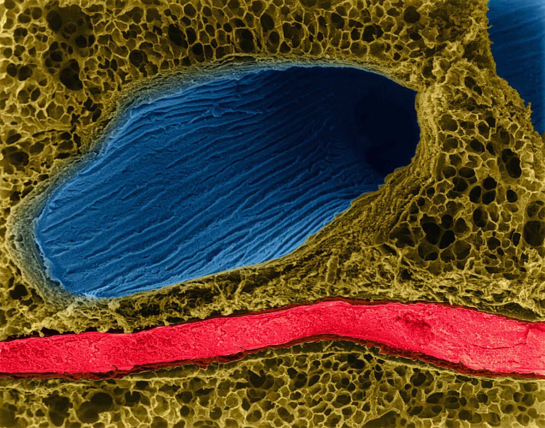 Respiratory bronchiole, alveoli and venule, SEM