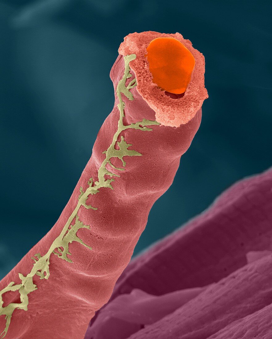 Capillary with red blood cells, SEM