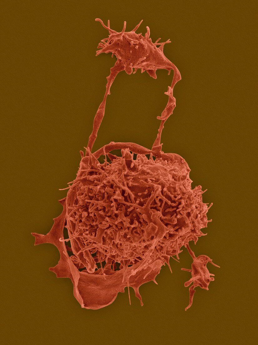Megakaryocyte and platelet formation, SEM