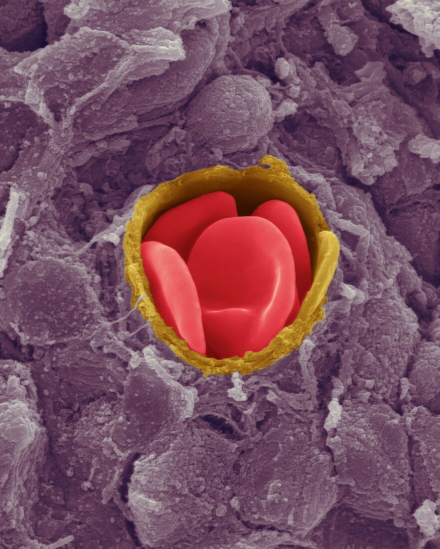 Human red blood cells in a capillary, SEM