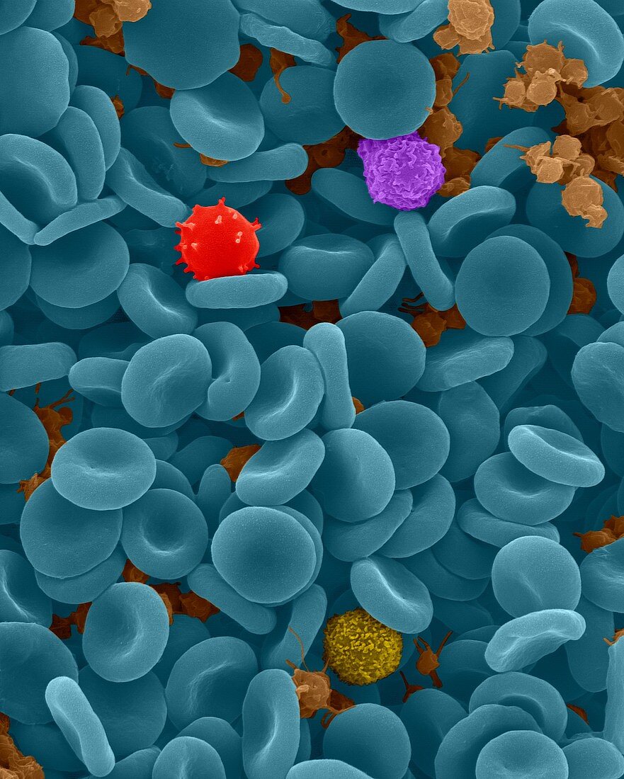 Red blood cells, white blood cells and platelets, SEM