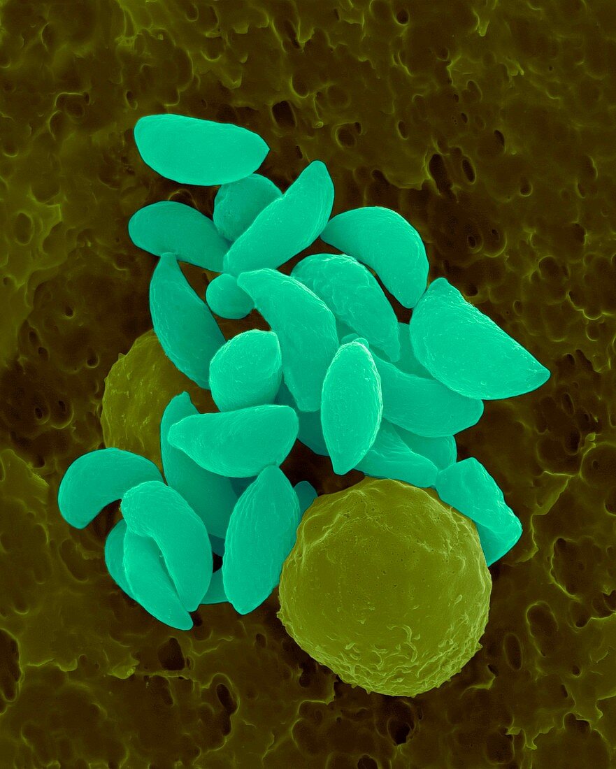 Parasitic protozoan tachyzoites, SEM