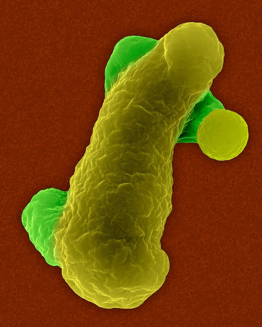 Parasitic amoeba (Entamoeba histolytica), SEM