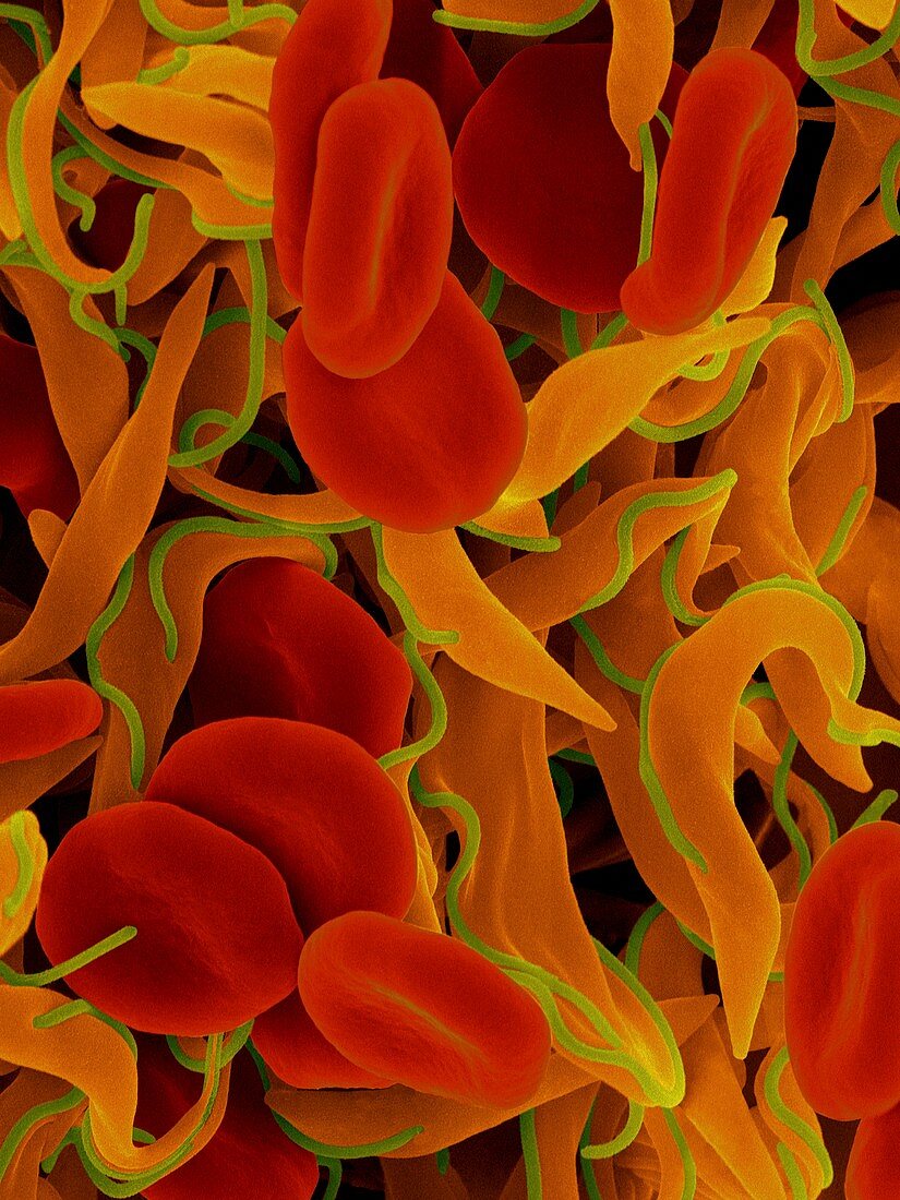 Trypanosome trypomastigote and red blood cells, SEM