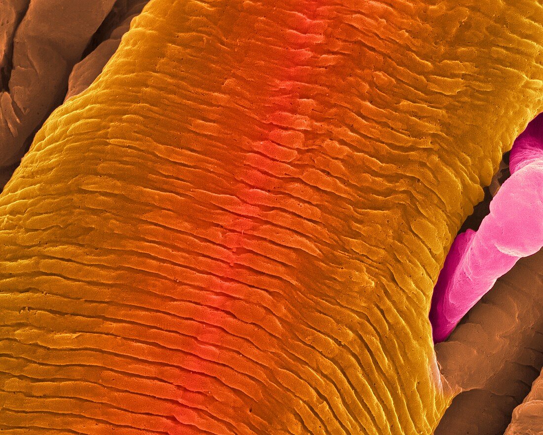 Contracted heart muscle fibre and capillary, SEM