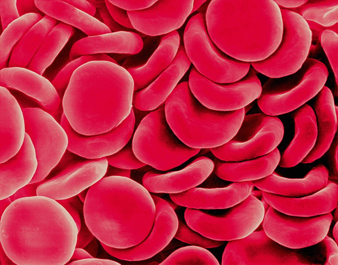 Red blood cells, SEM