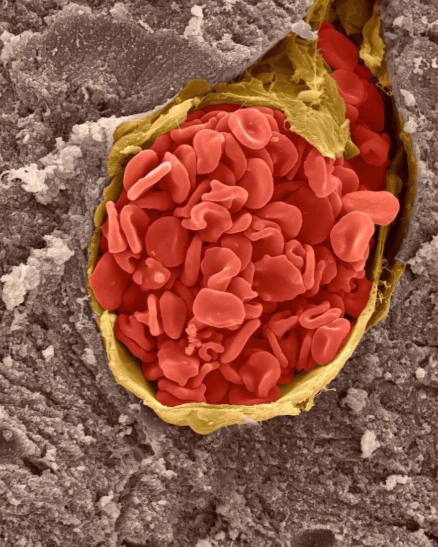 Artery with red blood cells, SEM
