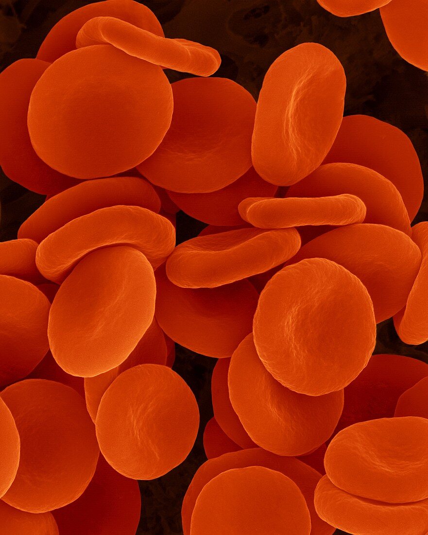 Red blood cells in isotonic solution, SEM