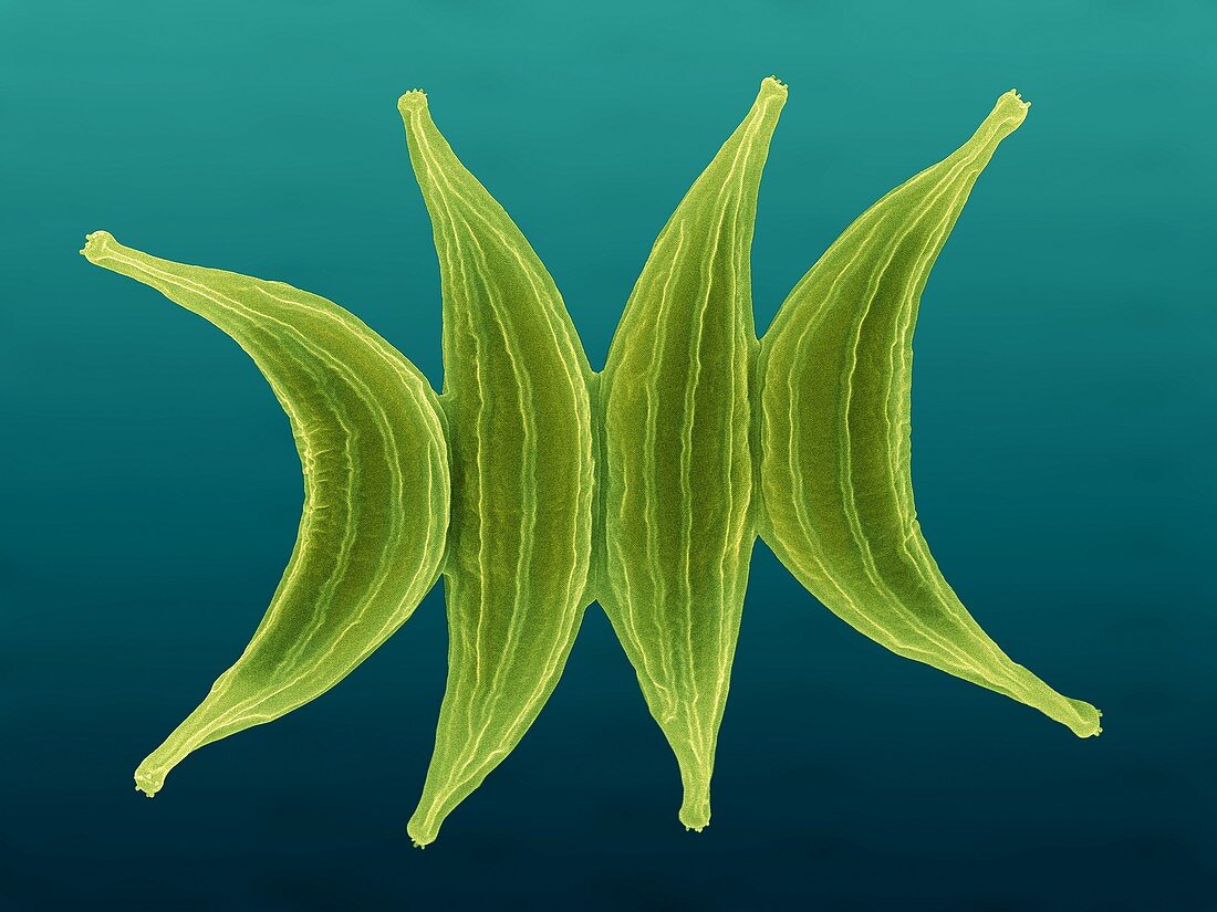 Scenedesmus spp., colonial green alga, SEM