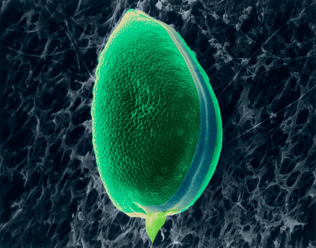 Dinoflagellate (Prorocentrum micans), SEM
