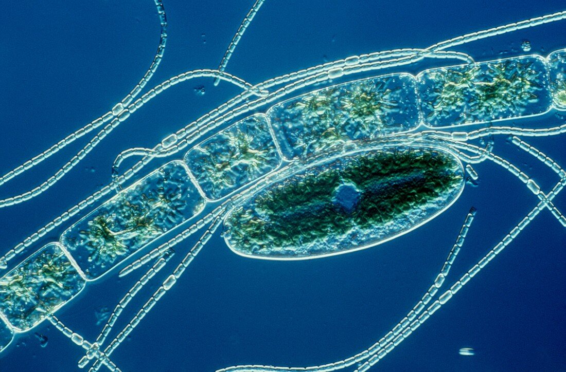 Cyanobacterium and green algae, LM