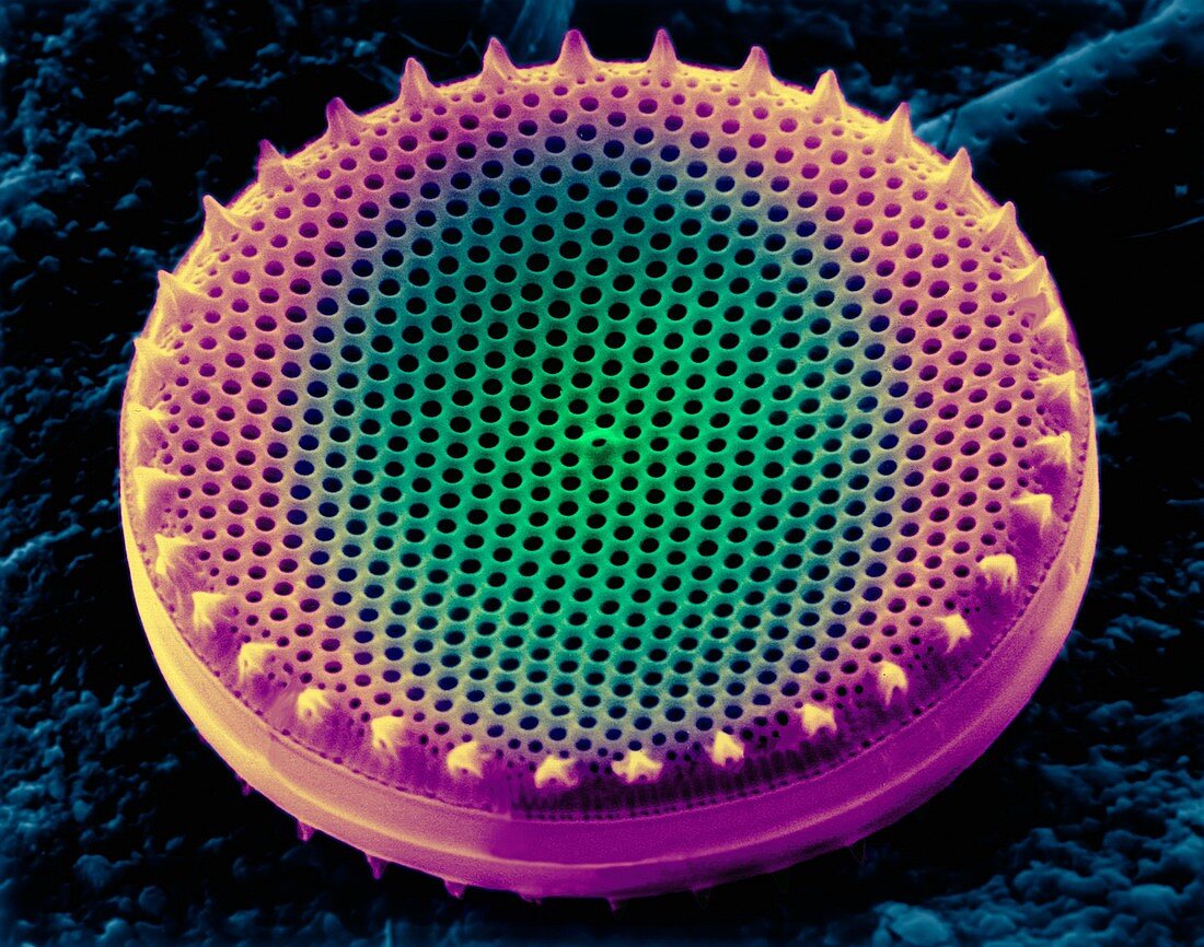 Diatom frustule (centric), SEM