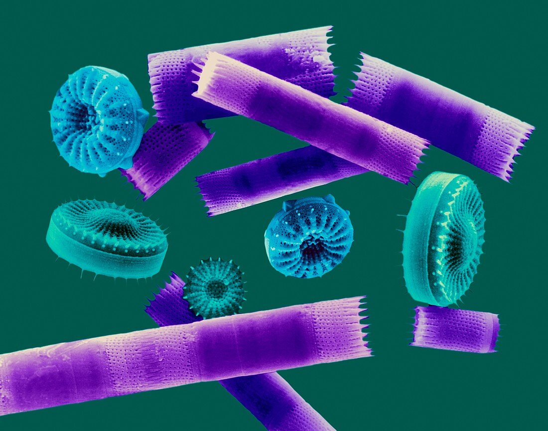Diatom frustules (centric), SEM