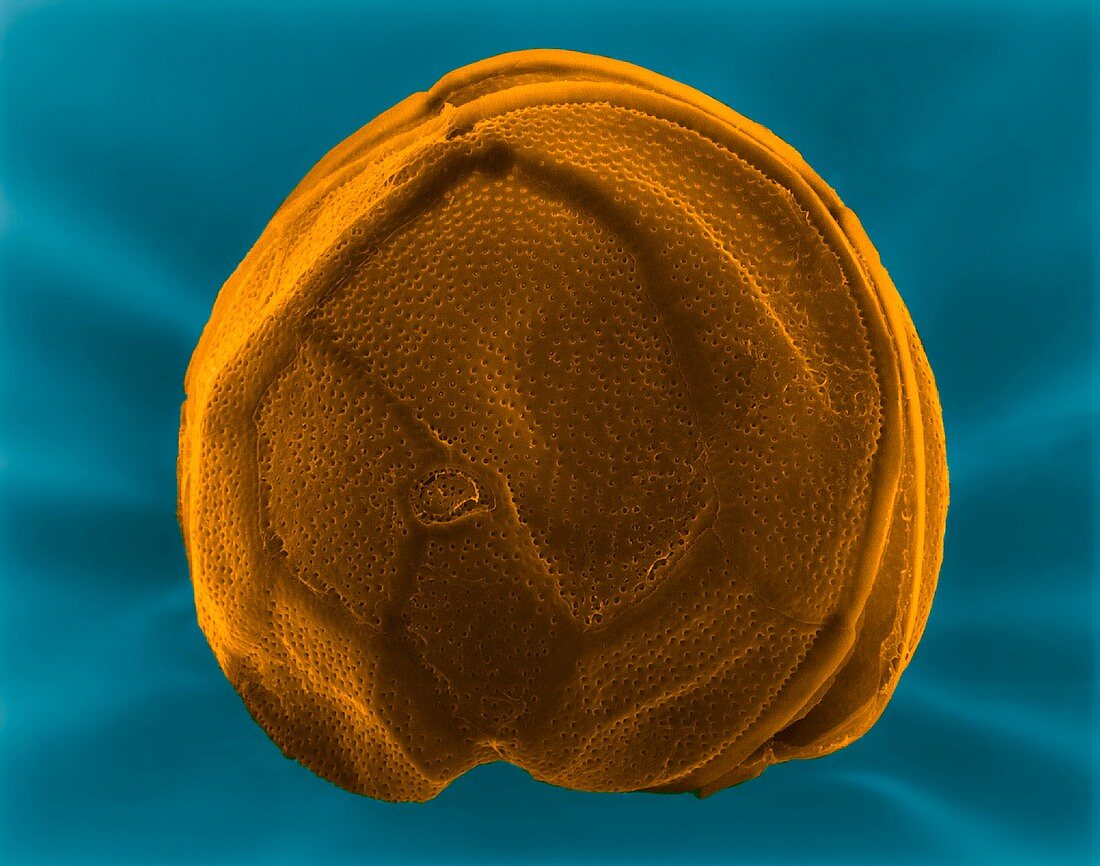 Dinoflagellate (Gambierdiscus toxicus), SEM