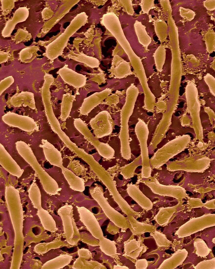 Halophilic archaea, SEM