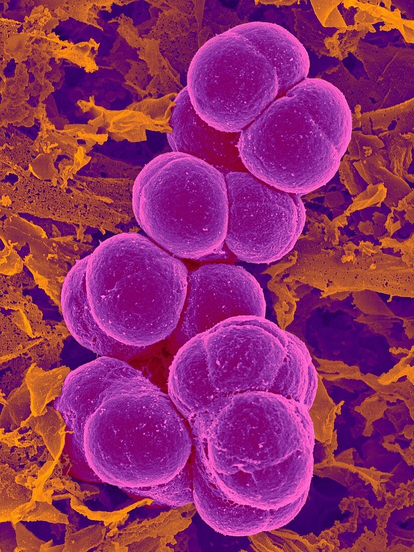 Methanotrophica archaea, SEM
