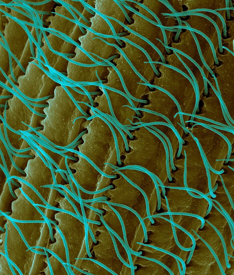 Ciliated protozoan (Tetrahymena vorax), SEM