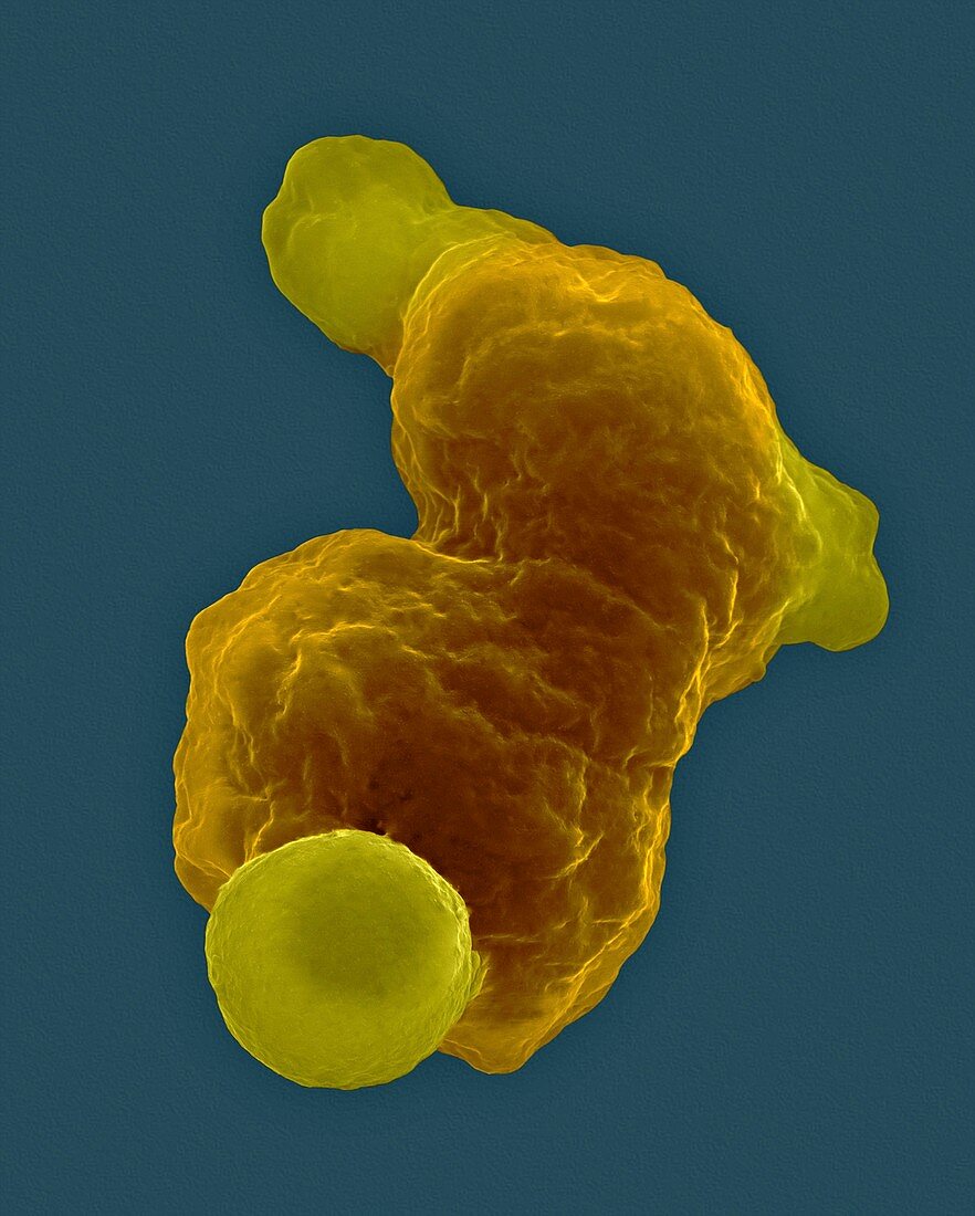 Parasitic amoeba (Entamoeba gingivalis) SEM