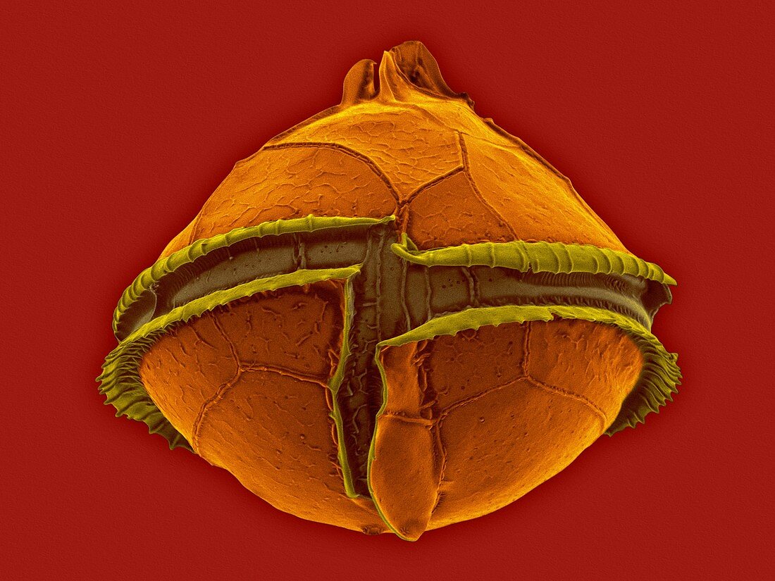Heterotrophic dinoflagellate (Oblea sp.), SEM