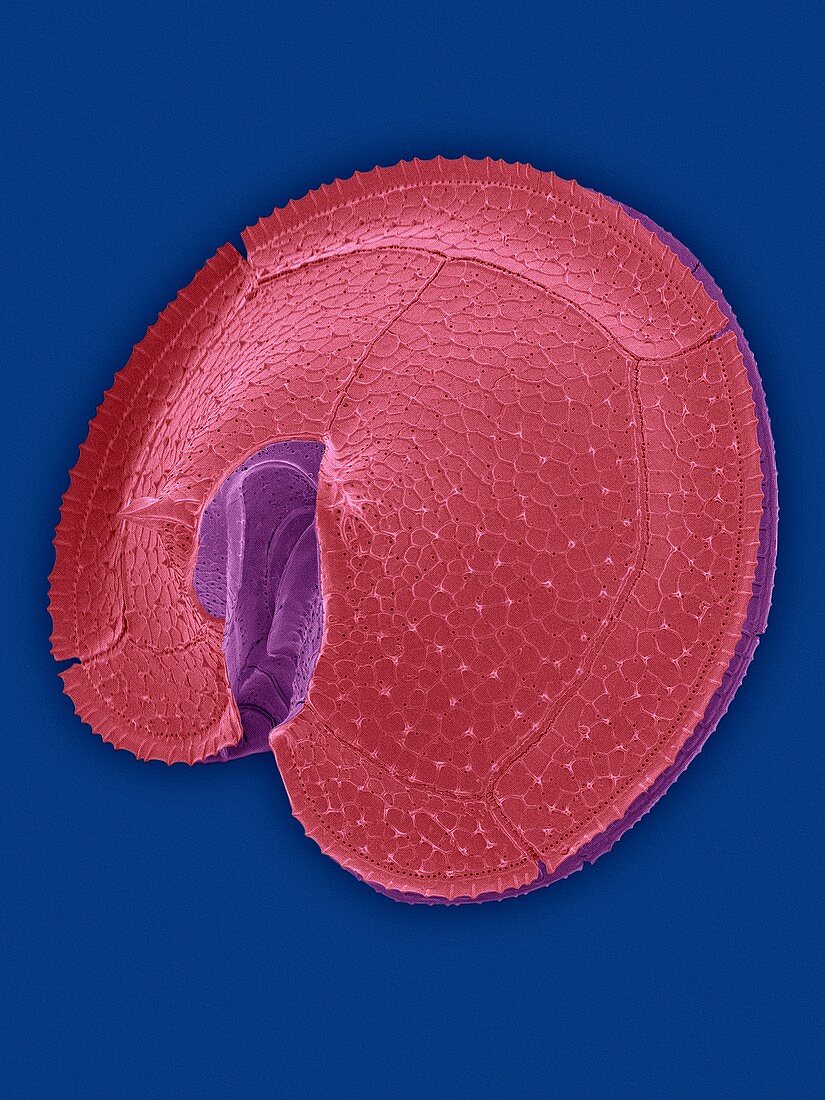 Heterotrophic dinoflagellate Protoperidinium sp., SEM