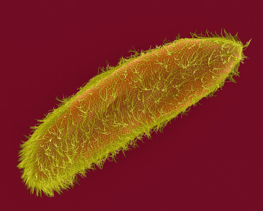 Ciliated protozoan (Paramecium sp.), SEM