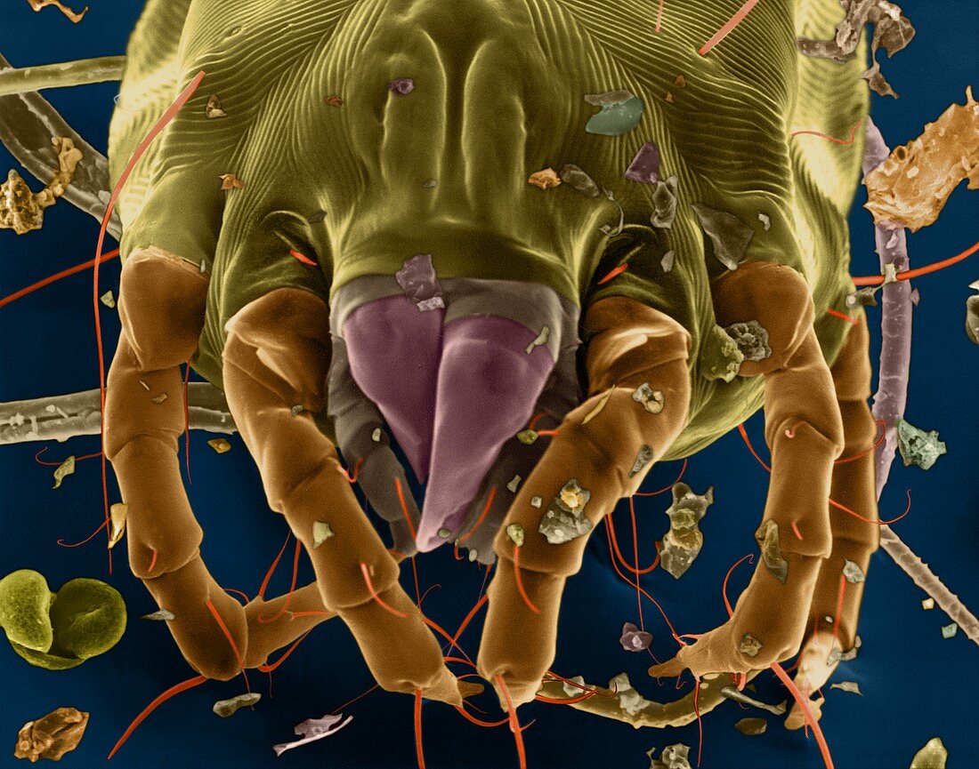 Dust mite, SEM