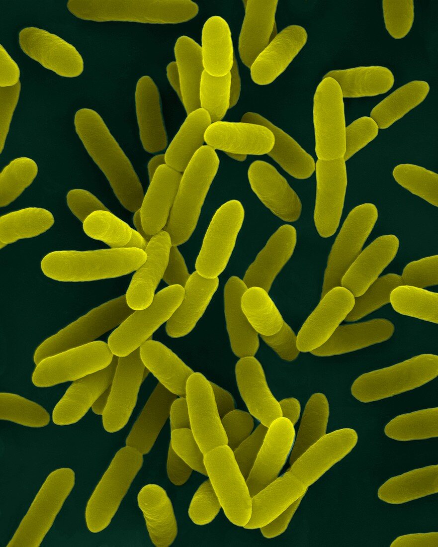 Yersinia enterocolitica, bacterium, SEM
