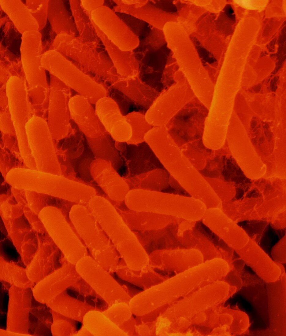 Oral bacterium, Actinomyces odontolyticus, SEM
