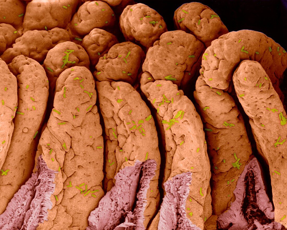 E. coli on the small intestine, SEM