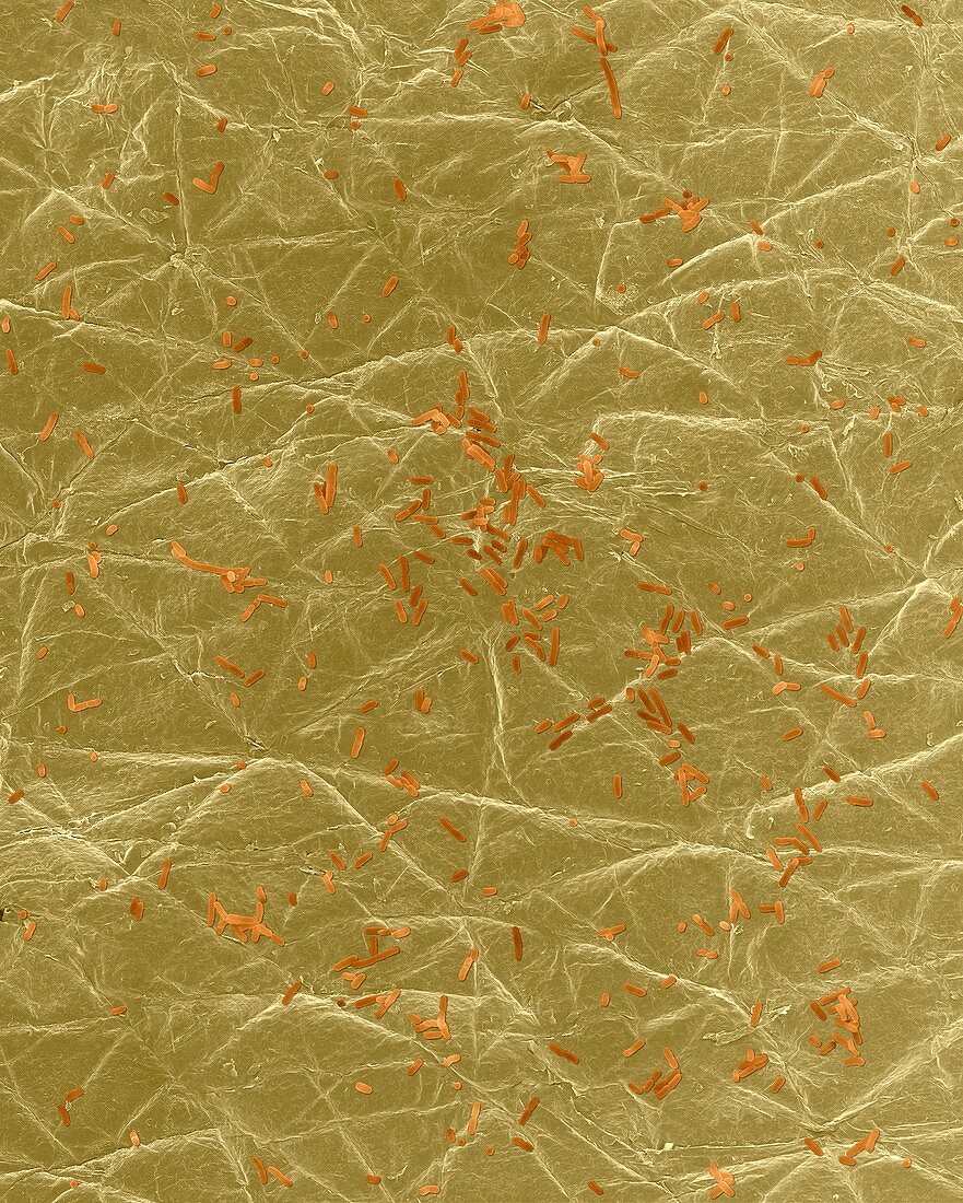 E. coli on the surface of human skin, SEM