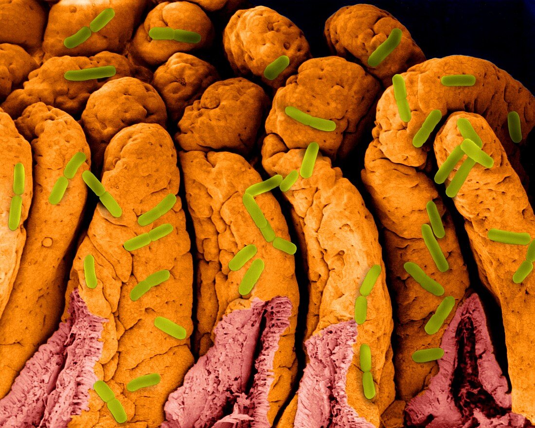 E. coli on small intestine surface, SEM