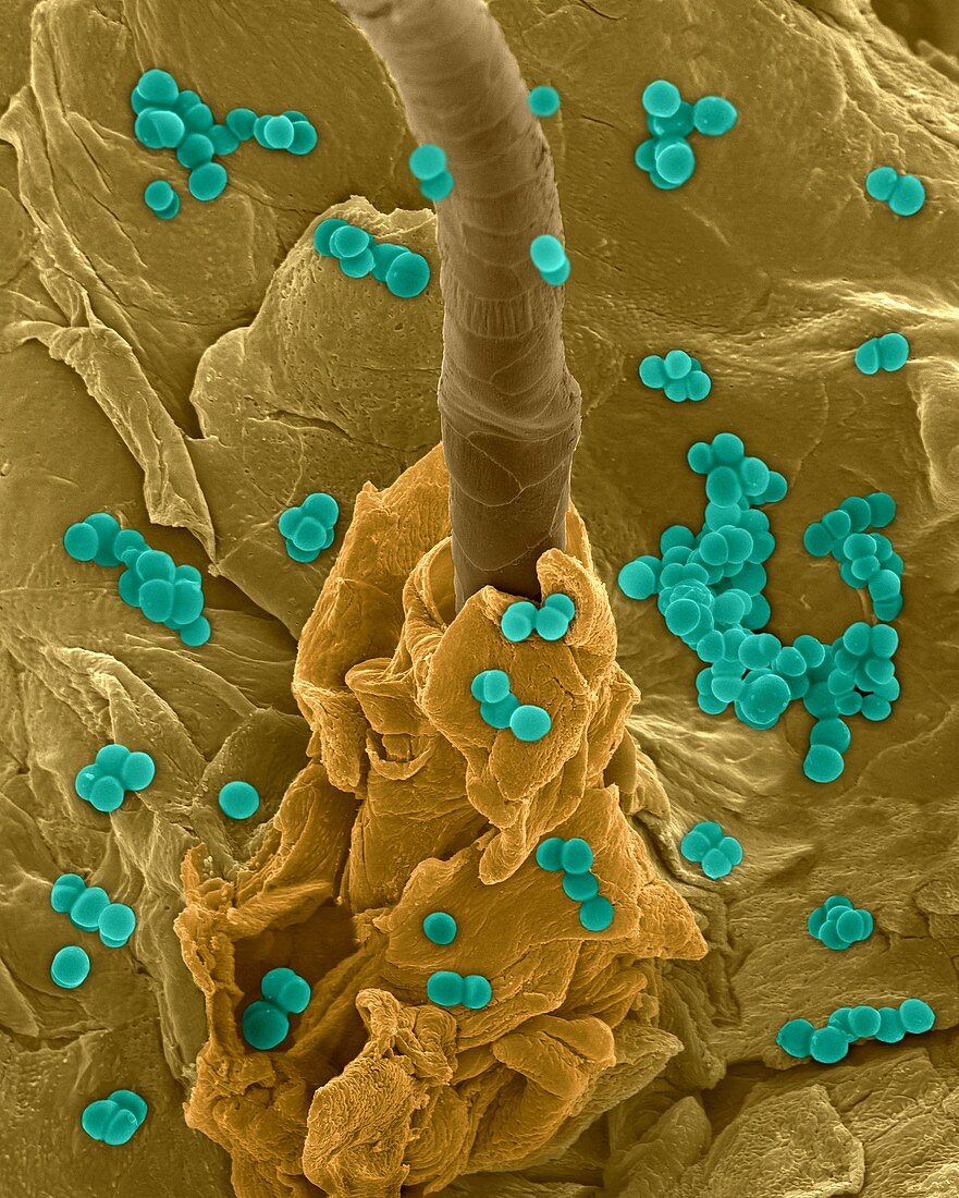 Staphylococcus aureus on human skin, SEM