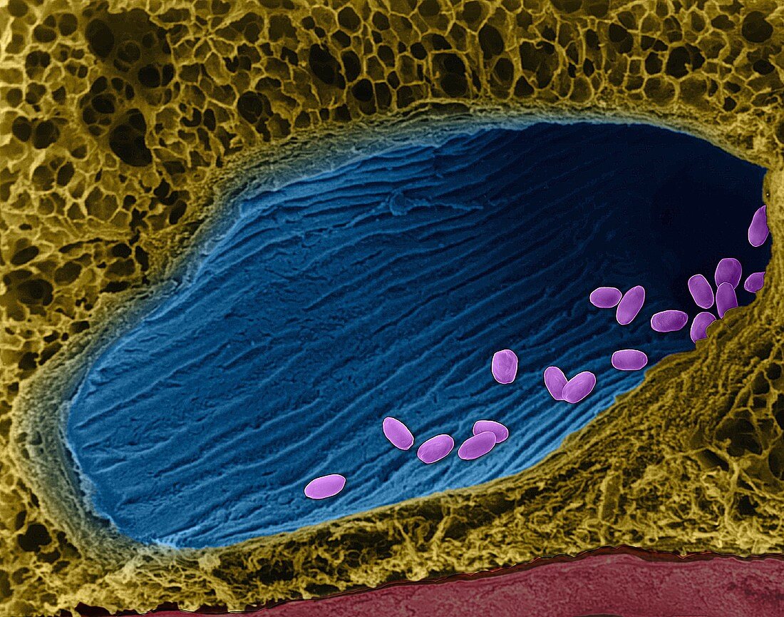 Bacillus anthracis spores in lung, SEM