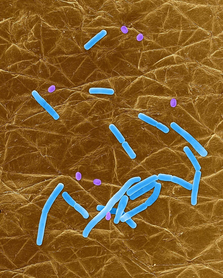 Bacillus anthracis, spore, prokaryote, SEM