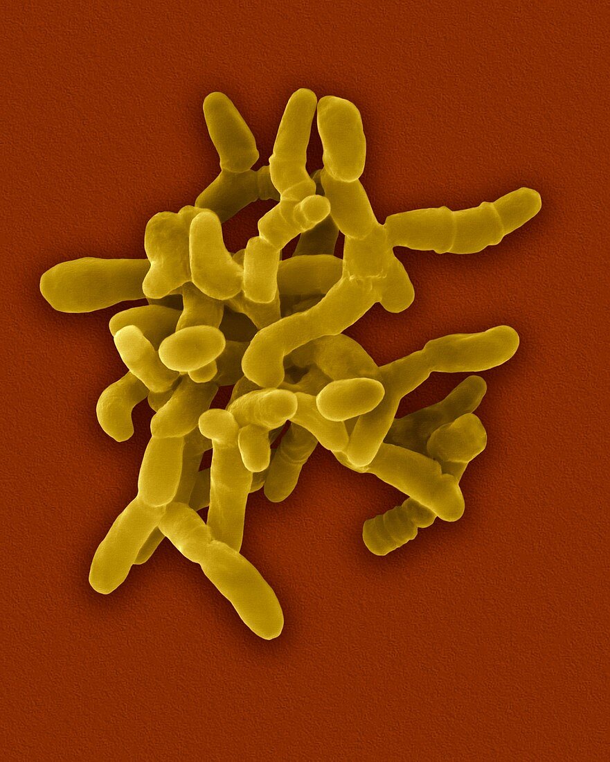 Mycobacterium paratuberculosis bacterium, SEM