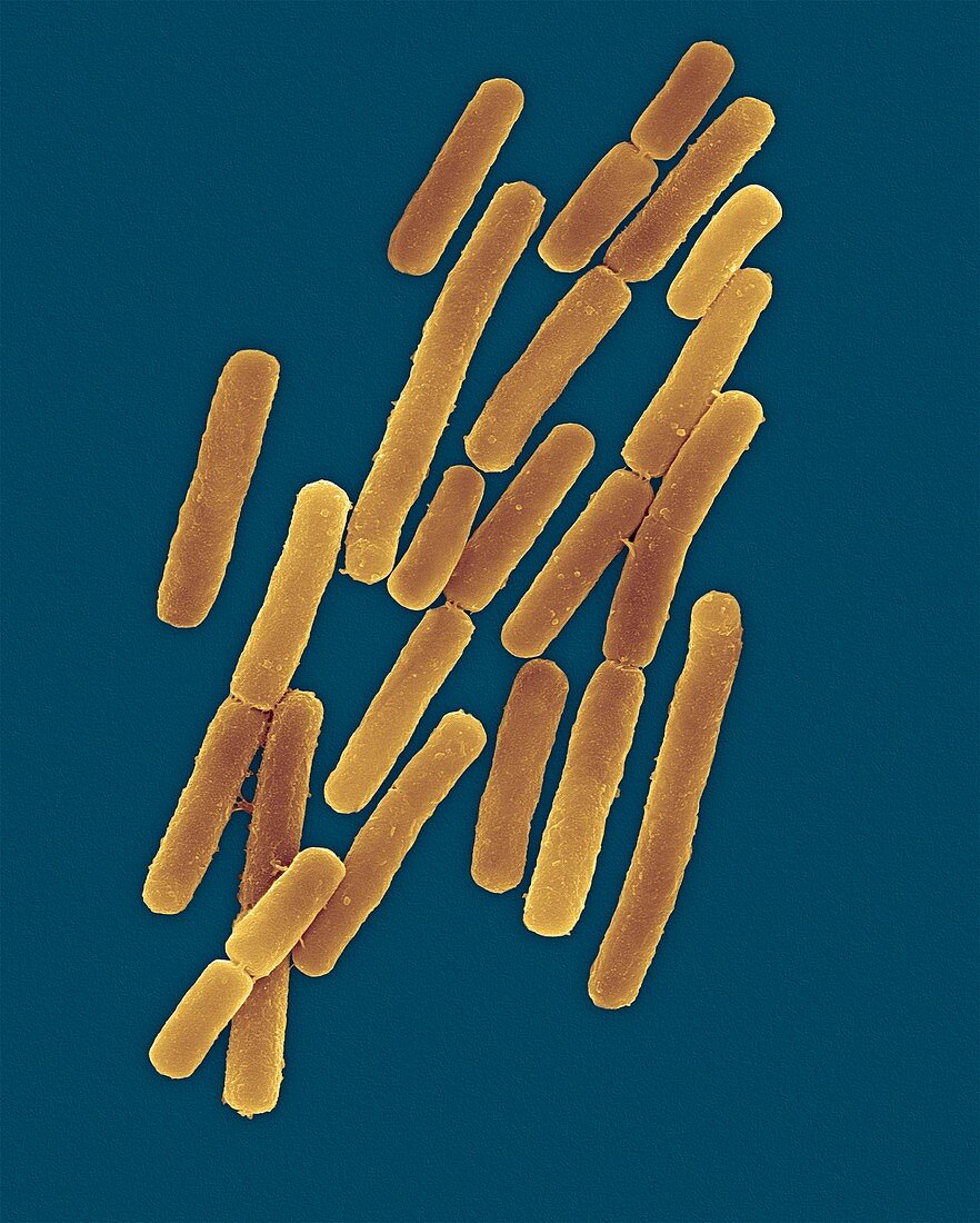 Clostridium difficile, spore forming, SEM