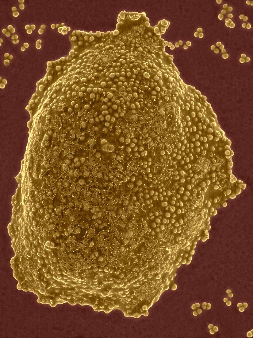 Staphylococcus aureus colony (MRSA strain), SEM
