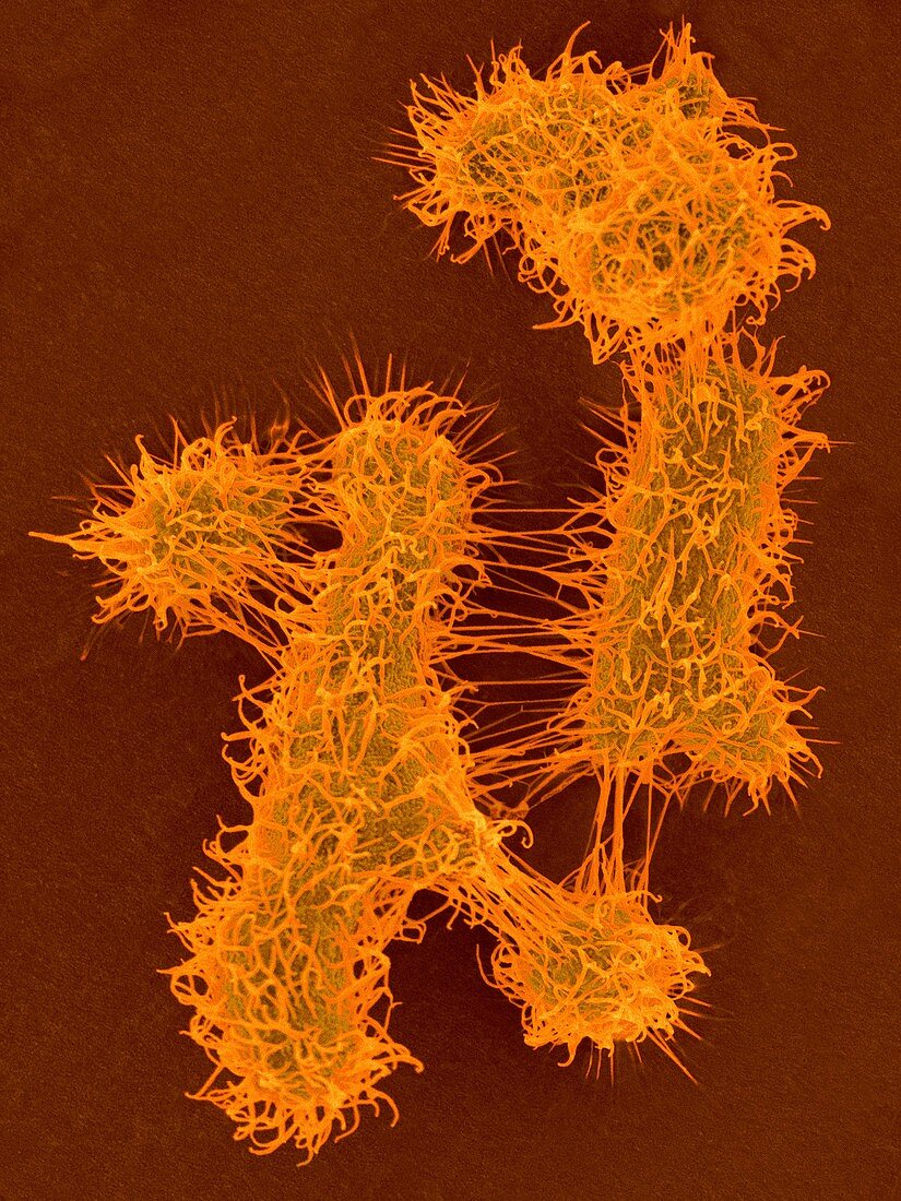 Labrys wisconsinensis, bacterium, SEM