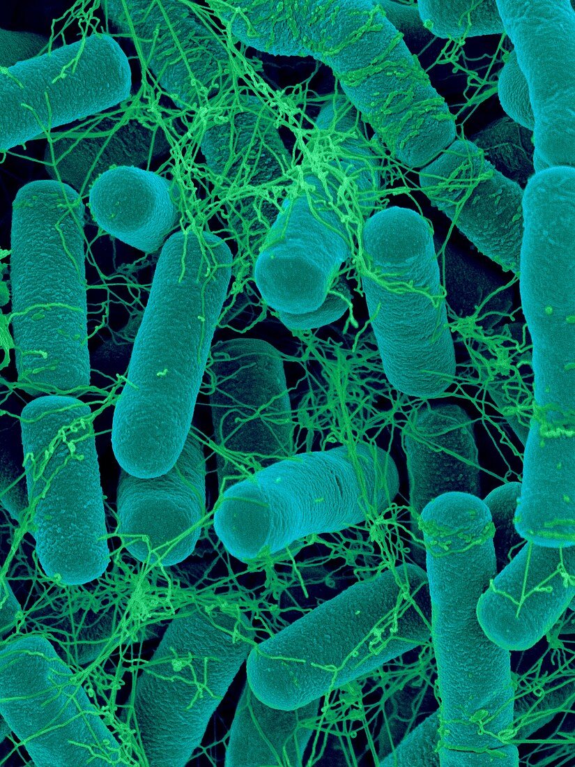 Bacillus thuringiensis, soil bacterium, SEM