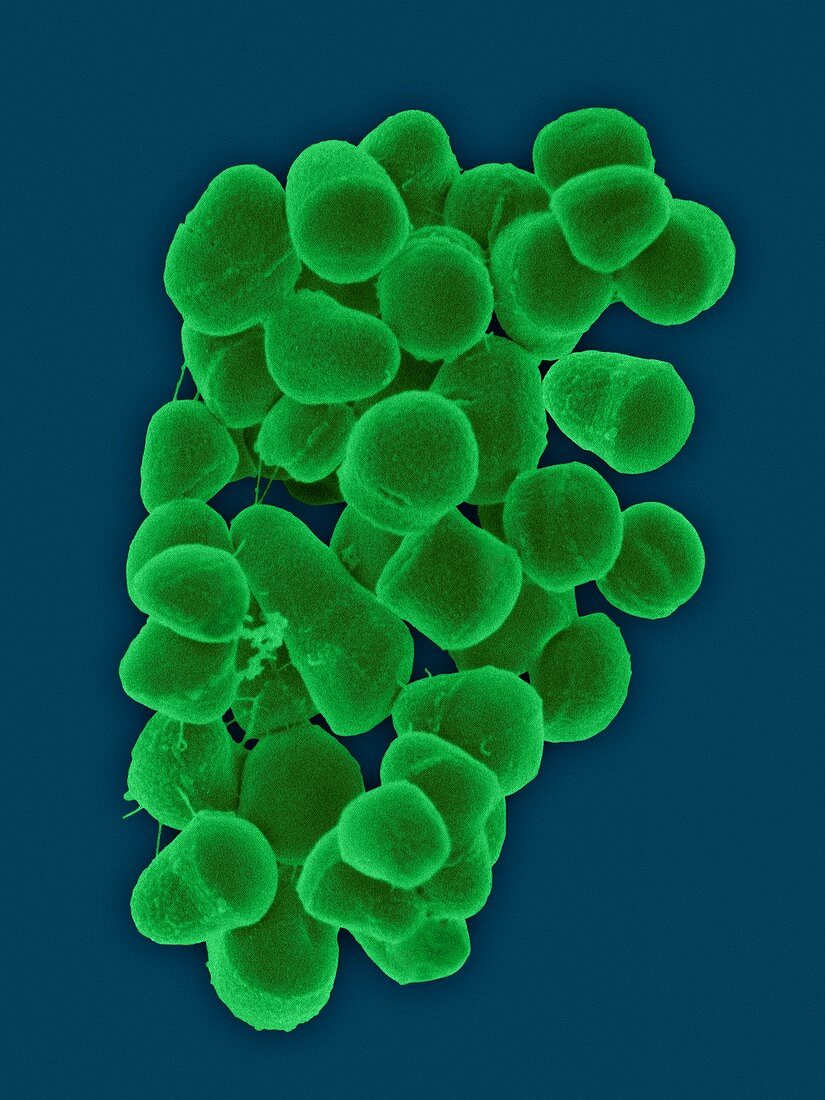 Tetrasphaera remsis, airborne bacterium, SEM