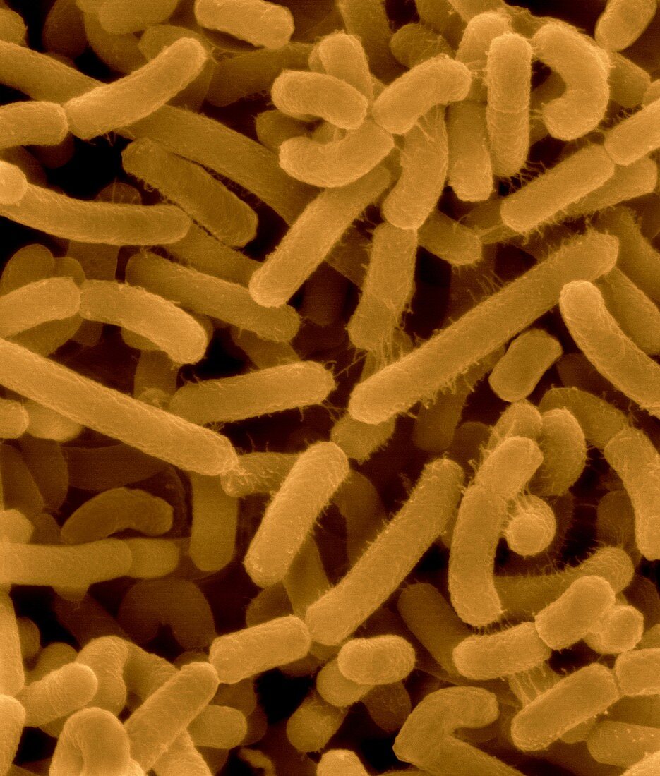 Agrobacterium tumefaciens, SEM
